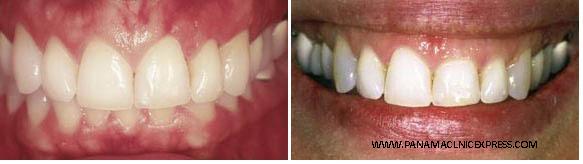 periodontal tissues treated